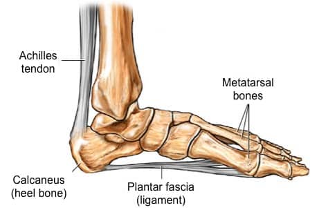 Plantar heel pain